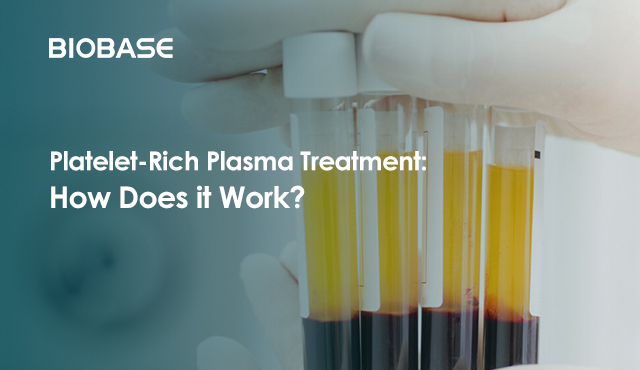 Platelet-Rich Plasma Treatment: How Does it Work?